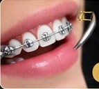 Detalle de brackets
